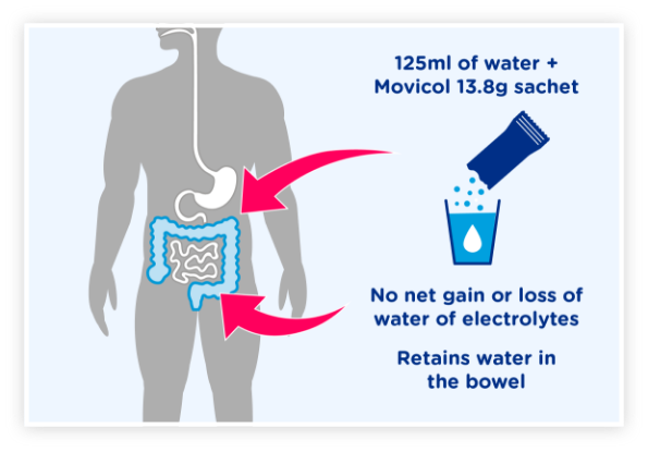 Graphic to show when taking Movicol there is no net gain or loss of water or electrolytes, Movicol helps retain water in the bowel